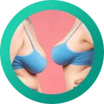 Mamoplastia Mais Cirurgia